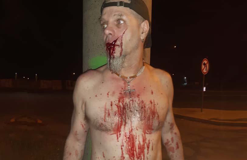 Brutal ataque al conocido baterista Baigorriense Sergio del Soldato